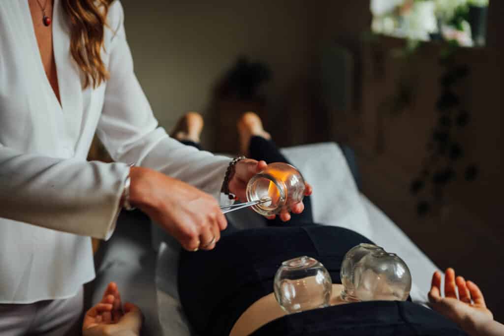 Acupuncturist Sheffield giving patient Fire cupping