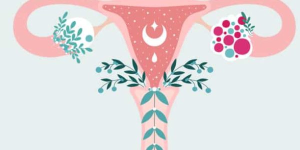 PCOS - Anatomical scheme of Uterus in flowers. Polycystic ovary syndrome - Diagram of reproductive system. Women health